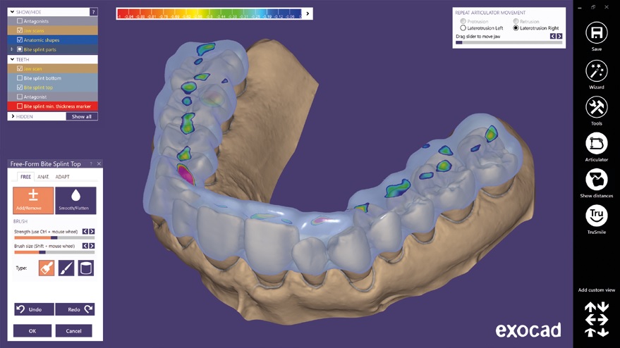 картинка Exocad Bite splint module - модуль шинирования зубов от магазина Udentis.ru