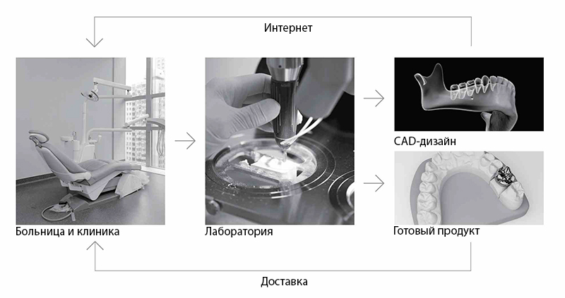Fussen S6000 – Стоматологический интраоральный 3D-сканер
