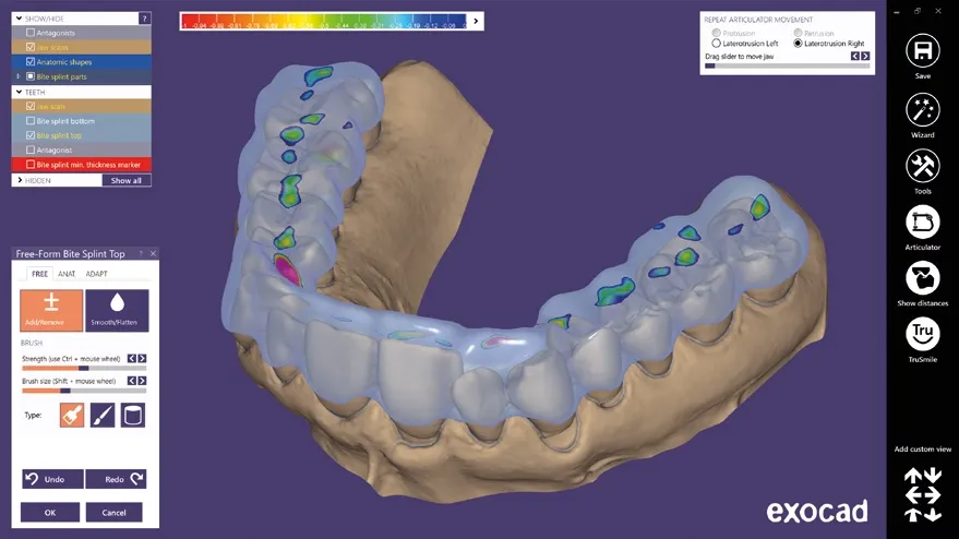 картинка Exocad Bite splint module - модуль шинирования зубов от магазина Udentis.ru